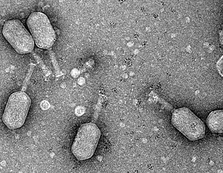 transmission electron microscope image phage particles